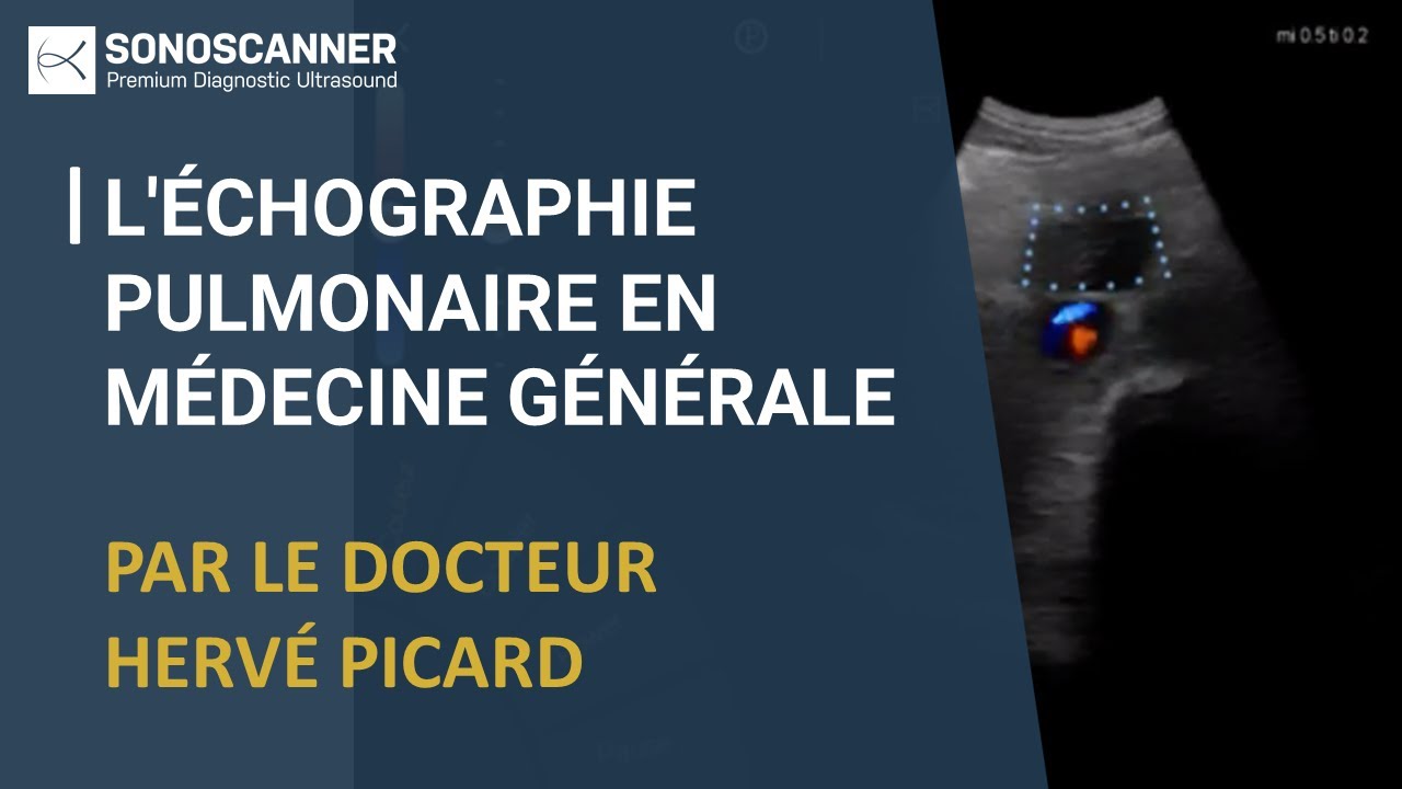 Webinar échographie en médecine générale: l'échographie Pulmonaire