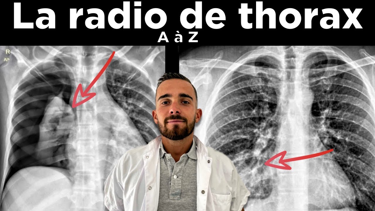 Radiographie de thorax de A à Z : Les bases d'interprétation