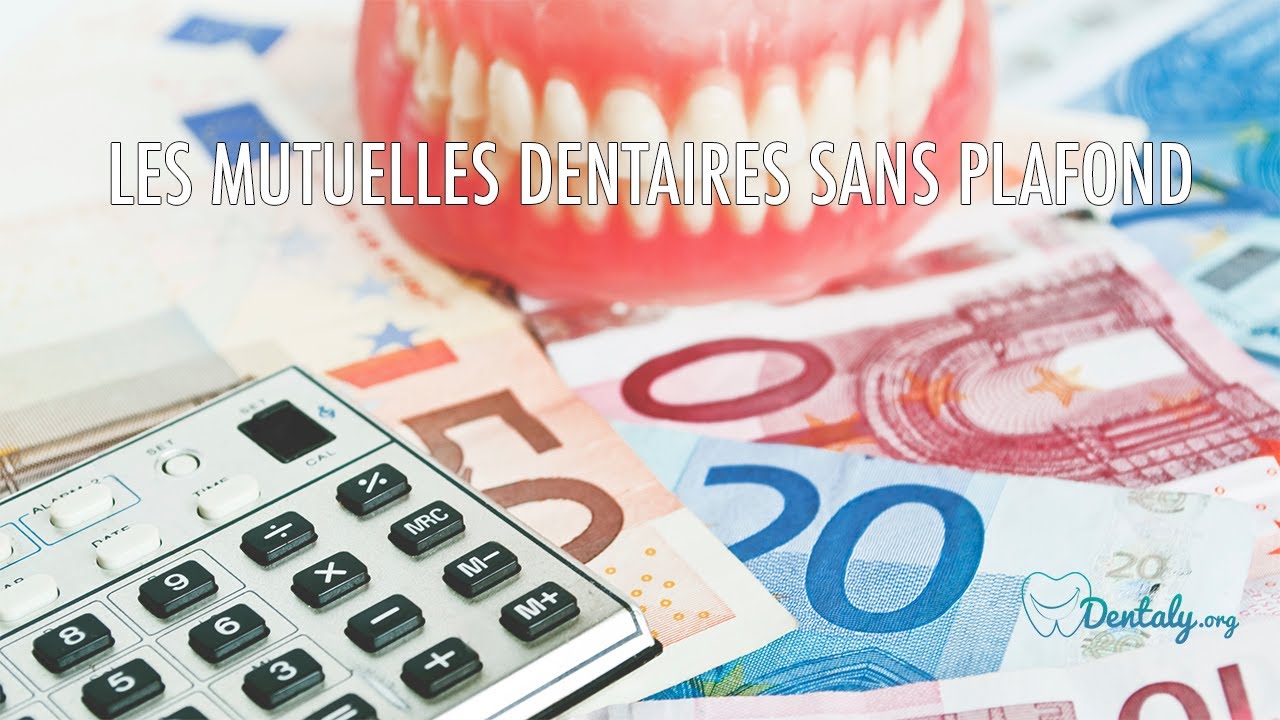 Mutuelle dentaire sans plafond :  la garantie d'une prise en charge optimale